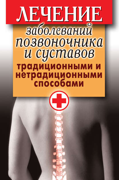 Лечение заболеваний позвоночника и суставов традиционными и нетрадиционными способами — Группа авторов