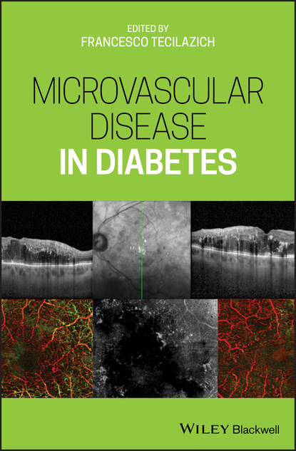 Microvascular Disease in Diabetes — Группа авторов