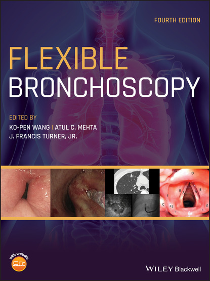 Flexible Bronchoscopy — Группа авторов