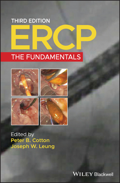 ERCP — Группа авторов