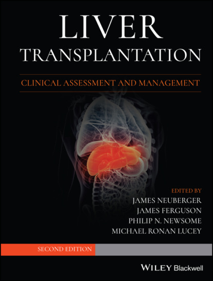 Liver Transplantation — Группа авторов