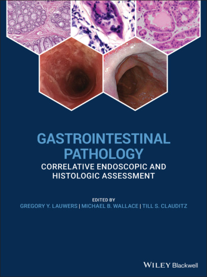 Gastrointestinal Pathology — Группа авторов