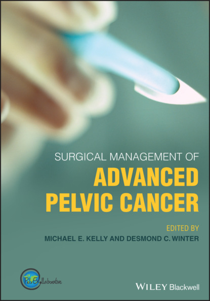 Surgical Management of Advanced Pelvic Cancer — Группа авторов