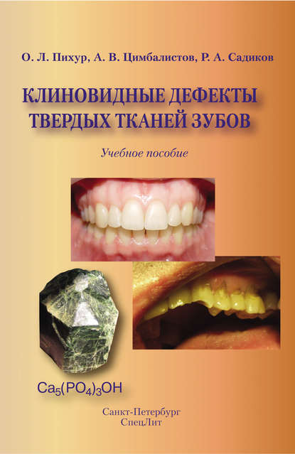 Клиновидные дефекты твердых тканей зубов — А. В. Цимбалистов