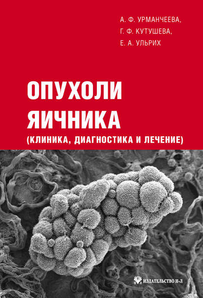 Опухоли яичника: клиника, диагностика и лечение — Е. А. Ульрих