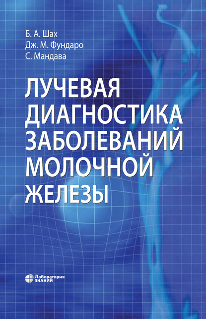 Лучевая диагностика заболеваний молочной железы — Джина М. Фундаро