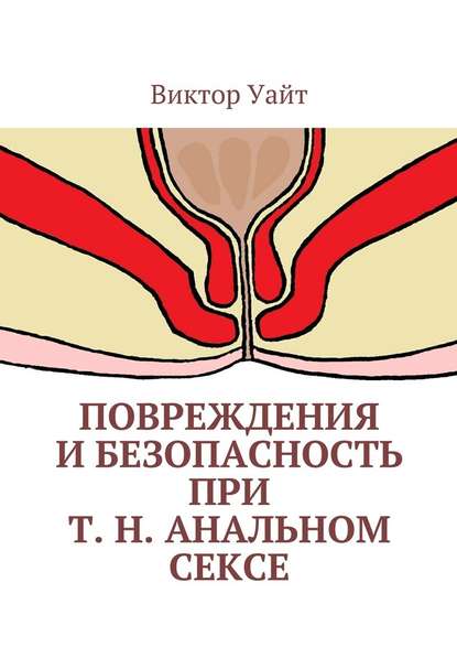 Повреждения и безопасность при т. н. анальном сексе — Виктор Уайт