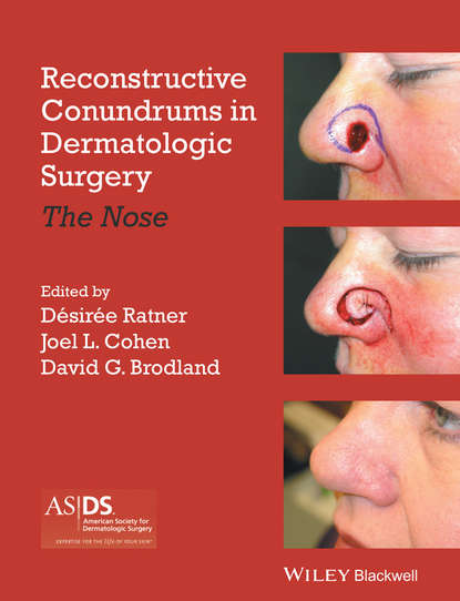 Reconstructive Conundrums in Dermatologic Surgery — Группа авторов
