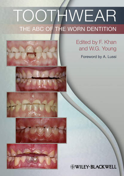 Toothwear — Группа авторов