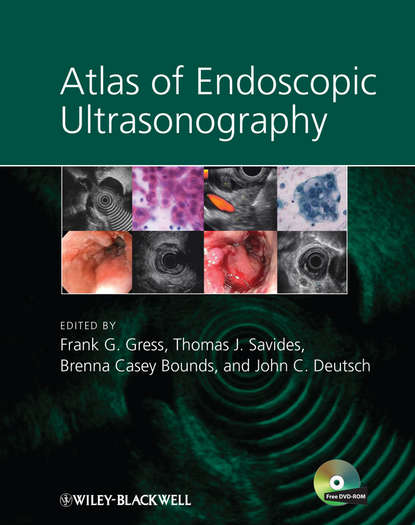 Atlas of Endoscopic Ultrasonography — Группа авторов