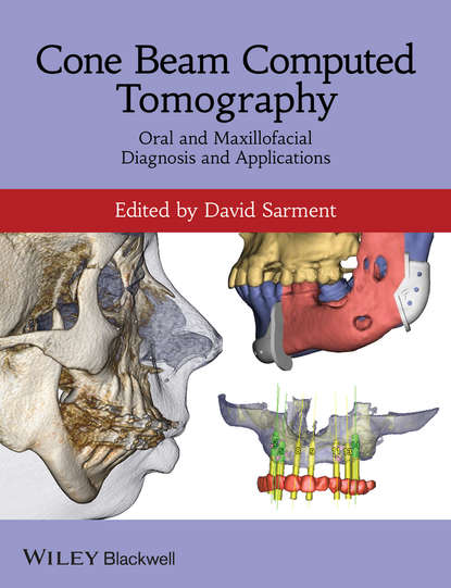 Cone Beam Computed Tomography — Группа авторов