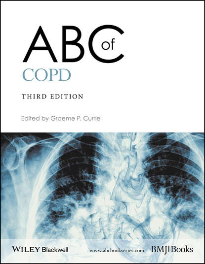 ABC of COPD — Группа авторов