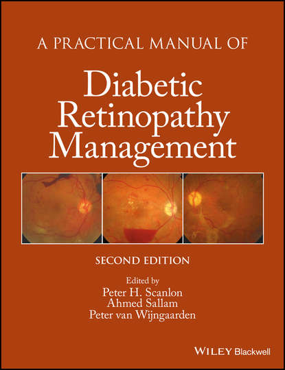 A Practical Manual of Diabetic Retinopathy Management — Группа авторов