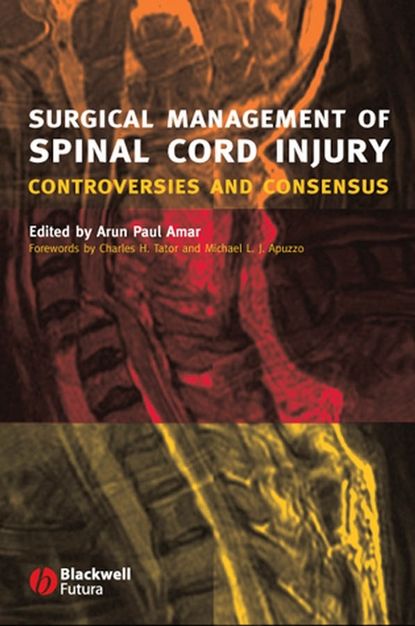 Surgical Management of Spinal Cord Injury — Группа авторов