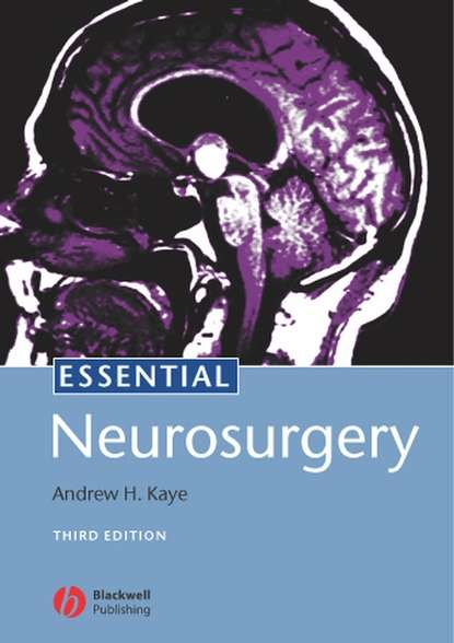 Essential Neurosurgery — Группа авторов